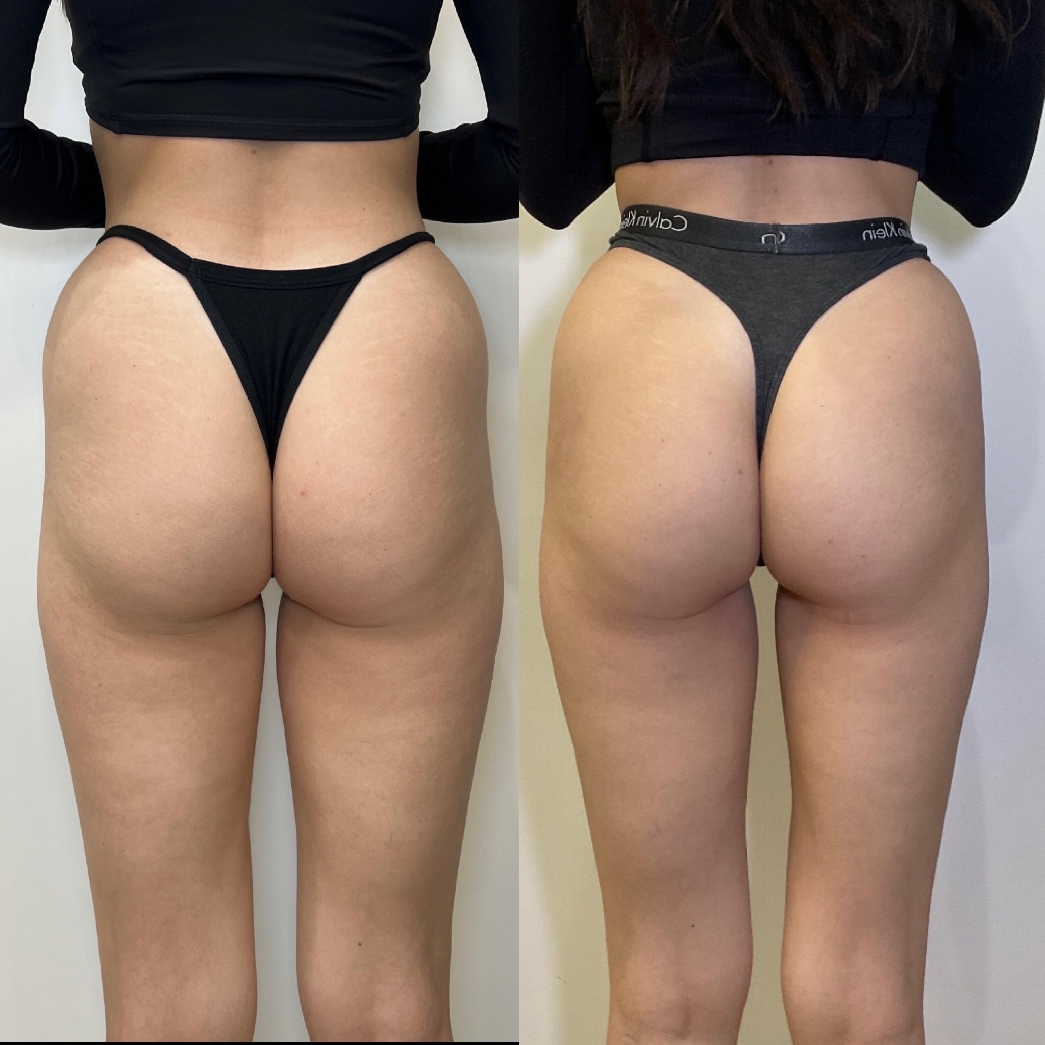 https://www.theperfectdose.net/wp-content/uploads/2025/06/2930FB27-A85C-453E-86C8-69FE040D1B58-1.jpeg