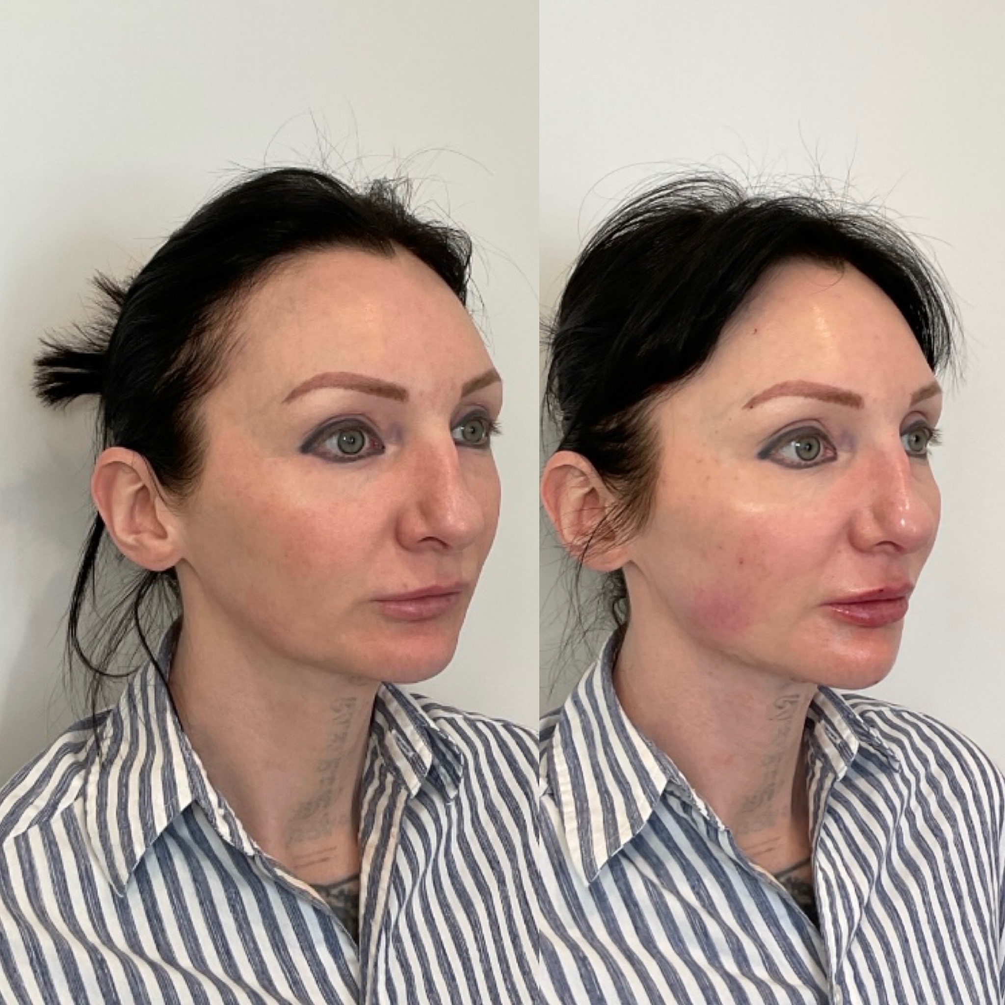 https://www.theperfectdose.net/wp-content/uploads/2025/07/full-facial-balancing-2.jpg